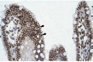 Human Intestine (POU6F1 antibody  (Middle Region))