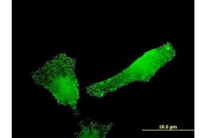 Immunofluorescence of monoclonal antibody to SH2D3C on HeLa cell. (SH2D3C antibody  (AA 1-110))