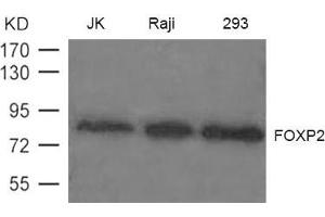 Western blot analysis of extract from JK, Raji and 293 cells using FOXP2 Antibody (FOXP2 antibody)