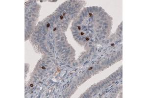 Immunohistochemical staining (Formalin-fixed paraffin-embedded sections) of human fallopian tube with CD8A monoclonal antibody, clone CL1529  shows strong positivity in a subset of lymphoid cells. (CD8 alpha antibody  (AA 64-147))