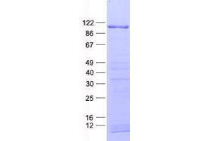 Validation with Western Blot (ZNF750 Protein (His tag))