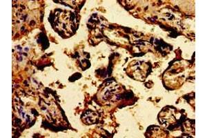 Immunohistochemistry of paraffin-embedded human placenta tissue using ABIN7172906 at dilution of 1:100 (TPT1 antibody  (AA 1-172))
