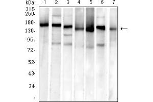 Western blot analysis using MSH6 mouse mAb against SH-SY5Y (1), Hela (2), PC-3 (3), HCT116 (4), HEK293 (5), A549 (6), and HepG2 (7) cell lysate.
