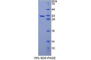 SDS-PAGE (SDS) image for Pyruvate Dehydrogenase beta (PDHB) (AA 65-336) protein (His tag) (ABIN1525571) (PDHB Protein (AA 65-336) (His tag))