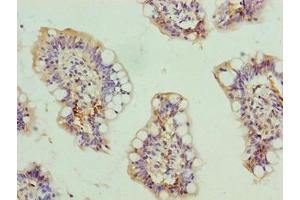Immunohistochemistry of paraffin-embedded human small intestine tissue using ABIN7168606 at dilution of 1:100 (SCARA3 antibody  (AA 201-466))