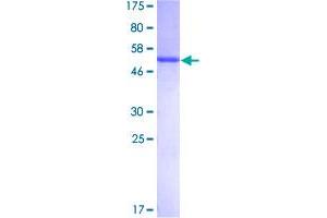 UNC119 Protein (AA 1-240) (GST tag)