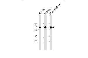 All lanes : Anti-SLC1A3 Antibody (N-Term) at 1:8000 dilution Lane 1: Human brain lysate Lane 2: Mouse brain lysate Lane 3: Mouse cerebellum lysate Lysates/proteins at 20 μg per lane. (SLC1A3 antibody  (AA 127-161))