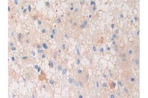 Immunohistochemistry (IHC) image for anti-Pregnancy Zone Protein (PZP) (AA 1212-1391) antibody (ABIN7436252)