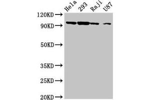 Western Blot Positive WB detected in: Hela whole cell lysate, 293 whole cell lysate, Raji whole cell lysate, U87 whole cell lysate All lanes: MASTL antibody at 6. (MASTL antibody  (AA 612-740))