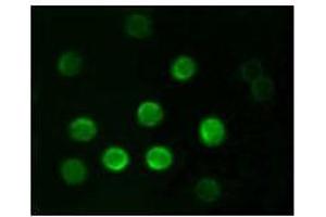 Immunofluorescence analysis of B lymphocytes using CD20 mouse mAb. (CD20 antibody)