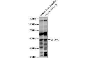 Western blot analysis of extracts of various cell lines, using GSDMC antibody (ABIN7268463) at 1:1000 dilution. (MLZE antibody  (AA 1-100))