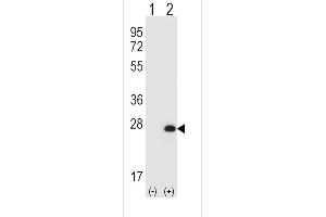 Western blot analysis of HPRT1 (arrow) using rabbit polyclonal HPRT1 Antibody (N-term) (ABIN652234 and ABIN2840981).