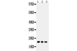 Western Blotting (WB) image for anti-Caveolin 2 (CAV2) (AA 1-17), (N-Term) antibody (ABIN3042683)