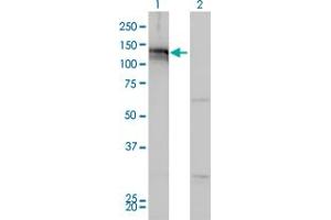 Western Blot analysis of AXL expression in transfected 293T cell line by AXL monoclonal antibody (M01), clone 6C8. (AXL antibody  (AA 30-140))