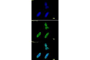 Histone H3 acetyl Lys9 antibody tested by immunofluorescence. (Histone 3 antibody  (acLys9))