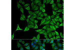 Immunofluorescence analysis of HeLa cells using KRT20 Polyclonal Antibody (KRT20 antibody)