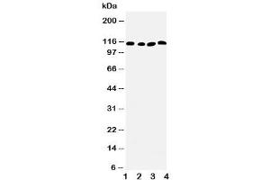 Western blot testing of SERCA2 ATPase antibody and Lane 1:  rat skeletal muscle (SERCA2 ATPase (Middle Region) antibody)