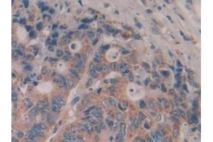 Immunohistochemistry (IHC) image for anti-Interleukin 35 (IL35) (AA 23-219) antibody (ABIN7438589)