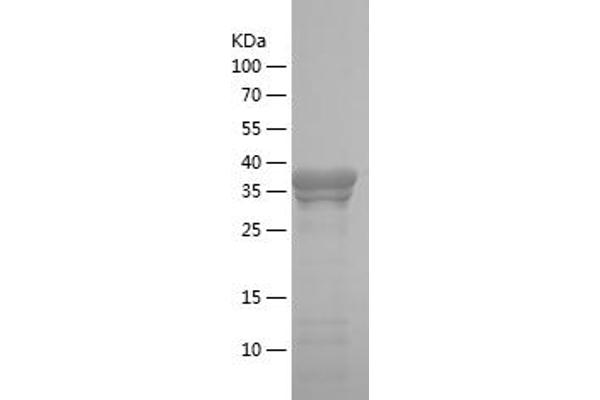 MTDH Protein (AA 168-298) (His-IF2DI Tag)