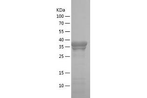 Western Blotting (WB) image for Metadherin (MTDH) (AA 168-298) protein (His-IF2DI Tag) (ABIN7123921)