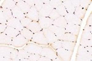 Immunohistochemistry analysis of paraffin-embedded rat muscle using,TBX10 (ABIN7075814) at dilution of 1: 4600 (T-Box 10 antibody)