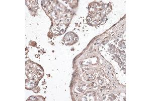 Immunohistochemistry of paraffin-embedded human placenta using MEF2C antibody (ABIN6132345, ABIN6143716, ABIN6143717 and ABIN6215998) at dilution of 1:100 (40x lens). (MEF2C antibody  (AA 170-380))