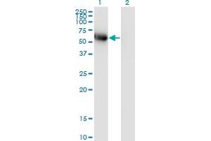 Western Blot analysis of BLK expression in transfected 293T cell line by BLK monoclonal antibody (M01), clone 3E5-3A8. (BLK antibody  (AA 1-505))