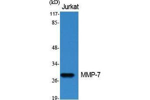 Western Blot (WB) analysis of specific cells using MMP-7 Polyclonal Antibody.