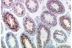 Immunohistochemistry (IHC) image for anti-SLA (Haploid Sperm Cell-Specific Antigen) antibody (ABIN3201019)