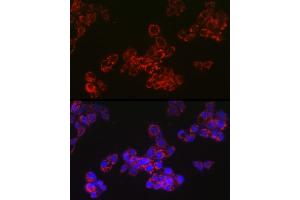 Immunofluorescence analysis of HepG2 cells using  Rabbit mAb (ABIN7265367) at dilution of 1:100 (40x lens). (ACAA2 antibody)