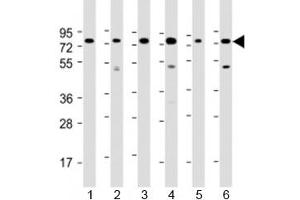 Western blot testing of human 1) Daudi, 2) HepG2, 3) Jurkat, 4) K562, 5) MOLT-4 and 5) Raji cell lysate with PABPC3 antibody at 1:2000.