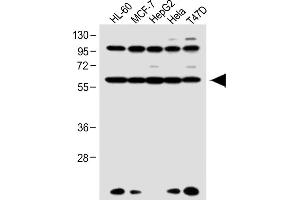 All lanes : Anti-RARA Antibody (C-term) at 1:1000 dilution Lane 1: HL-60 whole cell lysate Lane 2: MCF-7 whole cell lysate Lane 3: HepG2 whole cell lysate Lane 4: Hela whole cell lysate Lane 5: T47D whole cell lysate Lysates/proteins at 20 μg per lane. (Retinoic Acid Receptor alpha antibody  (C-Term))