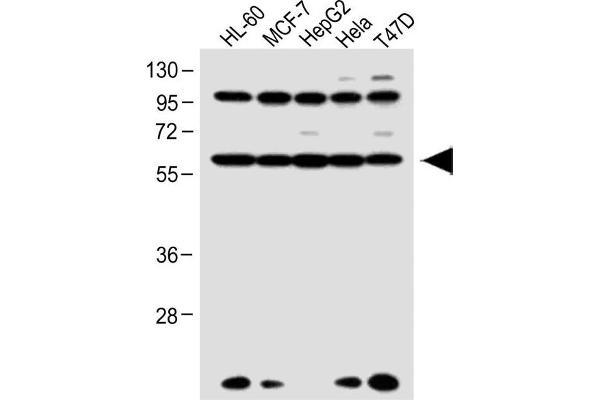 Retinoic Acid Receptor alpha antibody  (C-Term)