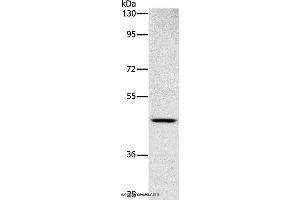 Western blot analysis of Human placenta tissue, using SIGLEC6 Polyclonal Antibody at dilution of 1:1000 (SIGLEC6 antibody)