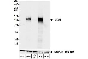 Western Blotting (WB) image for anti-Complement Component (3d/Epstein Barr Virus) Receptor 2 (CR2) (C-Term) antibody (ABIN7795815) (Recombinant CD21 antibody  (C-Term))