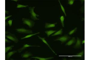 Immunofluorescence of purified MaxPab antibody to MDM4 on HeLa cell. (MDM4-binding Protein antibody  (AA 1-490))