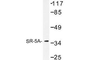Image no. 1 for anti-Serotonin Receptor 5A (HTR5A) antibody (ABIN317727) (Serotonin Receptor 5A antibody)