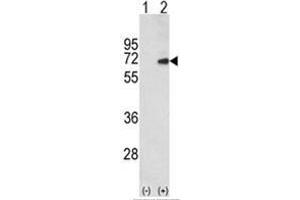 Western blot analysis of SMAD4 (arrow) using rabbit polyclonal SMAD4 Antibody (C-term) . (SMAD4 antibody  (C-Term))