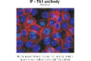 Image no. 1 for anti-Transglutaminase 1, Keratinocyte (TGM1) antibody (ABIN347015)