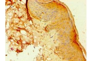 Immunohistochemistry of paraffin-embedded human skin tissue using ABIN7144295 at dilution of 1:100 (ANXA8L2 antibody  (AA 1-276))