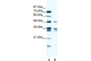 WB Suggested Anti-ZNF577 Antibody Titration:  1.