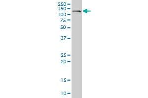 CDH17 monoclonal antibody (M01), clone 1H3. (LI Cadherin antibody  (AA 24-131))