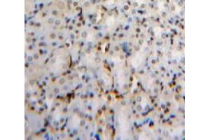 Used in DAB staining on fromalin fixed paraffin-embedded Kidney tissue (PHAP1 antibody  (AA 2-175))