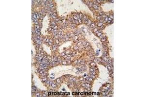 Image no. 2 for anti-Transient Receptor Potential Cation Channel, Subfamily M, Member 8 (TRPM8) (C-Term) antibody (ABIN360715) (TRPM8 antibody  (C-Term))