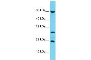 Host: Rabbit Target Name: C17orf102 Sample Type: MCF7 Whole Cell lysates Antibody Dilution: 1. (C17orf102 antibody  (Middle Region))