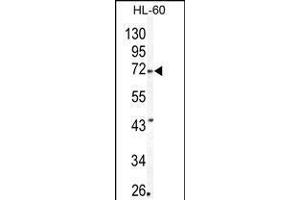 Western blot analysis of MMP24 Antibody in HL60 cell line lysates (35ug/lane) (MMP24 antibody  (AA 396-425))