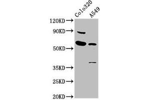 Western Blot Positive WB detected in: Colo320 whole cell lysate, A549 whole cell lysate All lanes: EBF3 antibody at 5. (EBF3 antibody  (AA 416-530))