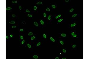 Immunofluorescent analysis of Hela cells (sodium butyrate, 30 mM, 4h) using ABIN7139188 at dilution of 1:100 and Alexa Fluor 488-congugated AffiniPure Goat Anti-Rabbit IgG(H+L) (HIST1H1E antibody  (acLys51))