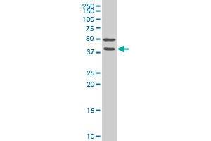 FRZB monoclonal antibody (M02), clone 4E5 Western Blot analysis of FRZB expression in Hela S3 NE . (FRZB antibody  (AA 102-190))