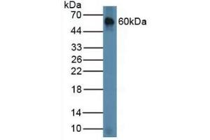 Detection of CHRD in Mouse Lung Tissue using Polyclonal Antibody to Chordin (CHRD) (Chordin antibody  (AA 422-635))